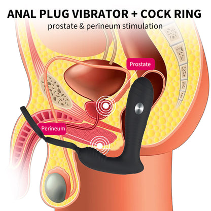 Wireless Remote Control Electric Shock Prostate Massager With Double Penis Ring-EROSREALM